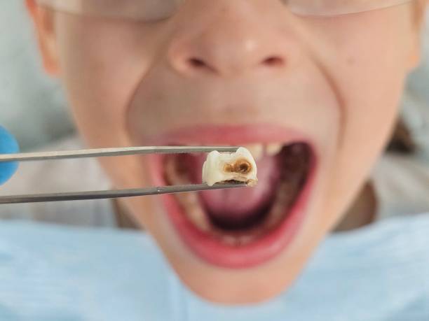 Best Pediatric Emergency Dentist in West Peoria, IL